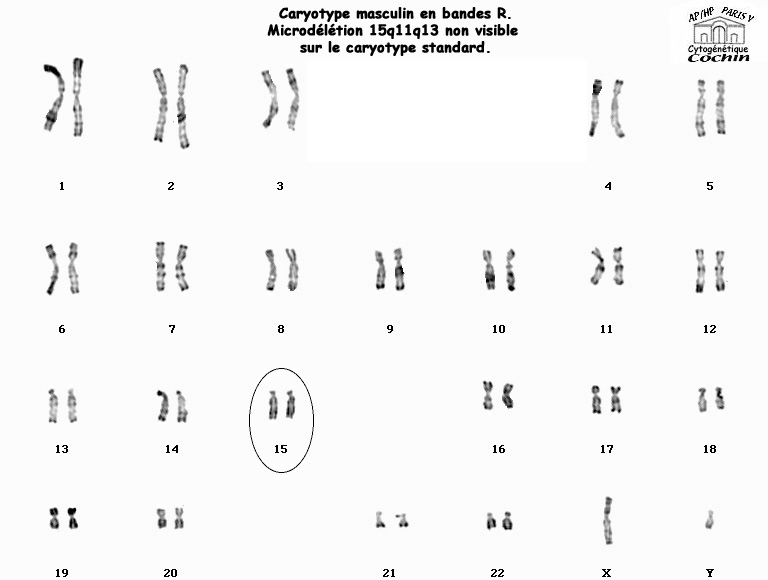 Caryotype Masculin En Bandes R