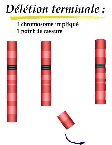 Vue entière