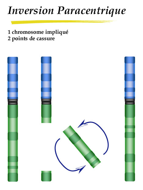Echelle maximale